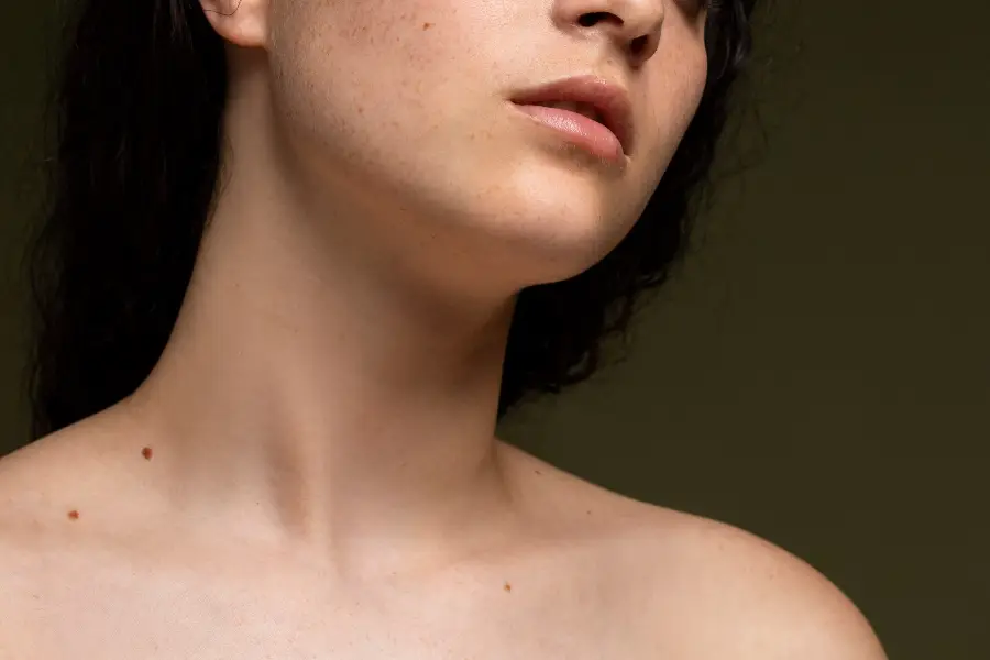 Side view woman skin texture with moles